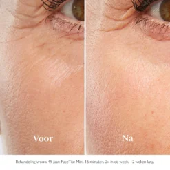 FaceTite Mini -Schoon Zacht Verkoopwinkel uObDyI1083304 6 dgl NL